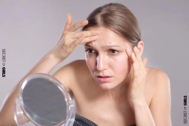 8 Ways To Get Rid Of Acne Now And For
