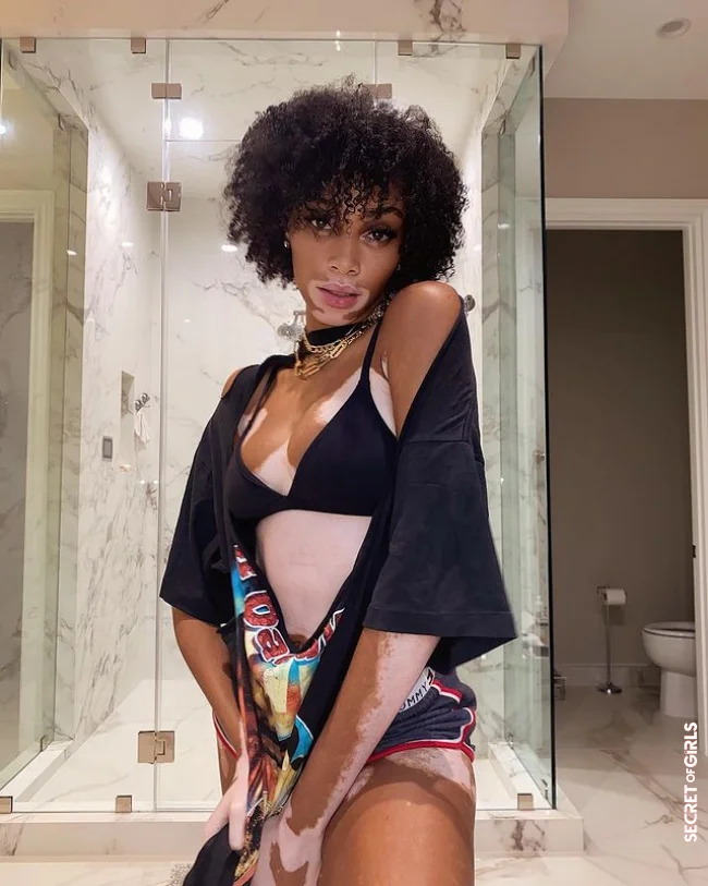 Winnie Harlow with a curly fringe | Get Inspiration From The Celebrities For Your Trendy Hairstyle With Bangs