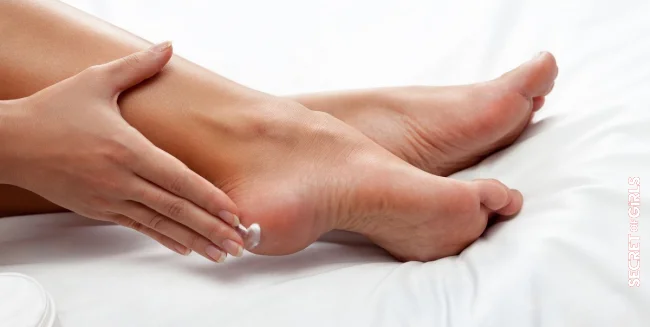 Prevent calluses: That's why creams are so important | Remove Calluses: Best Tips For Supple Feet