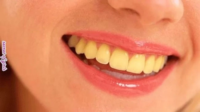 How to Whiten Your Teeth Naturally at Home