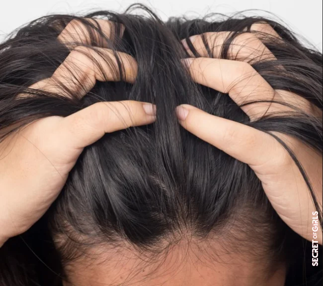 How do I get rid of painful hair roots immediately? | Hair Roots Hurt: How To Prevent "Hair Pain"?