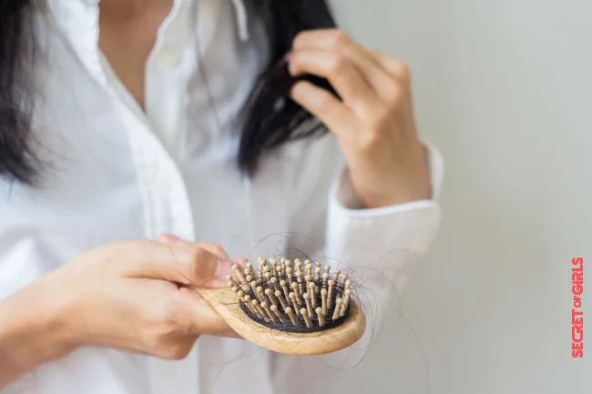Treatments can be prescribed for hair loss | Hair Loss, Dull Color… How To Keep Hair Healthy After 40 Years (And Even Before)?