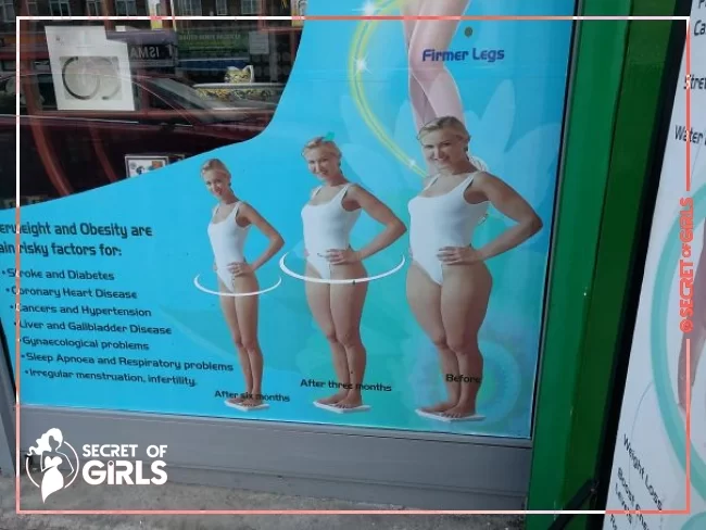 #71 This Is On A Window In London. It's Supposed To Promote Some Weight Loss/diet Thing The Image Of The Woman Was Just Stretched In Photoshop | 83 Photoshop Fails That Are So Horrible It’s Hard To Believe They Were Missed